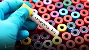 Boletim Epidemiológico: MS registra 9.832 casos confirmados de chikungunya